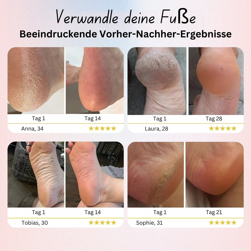 Elektrische Fussfeile