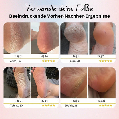 Elektrische Fussfeile